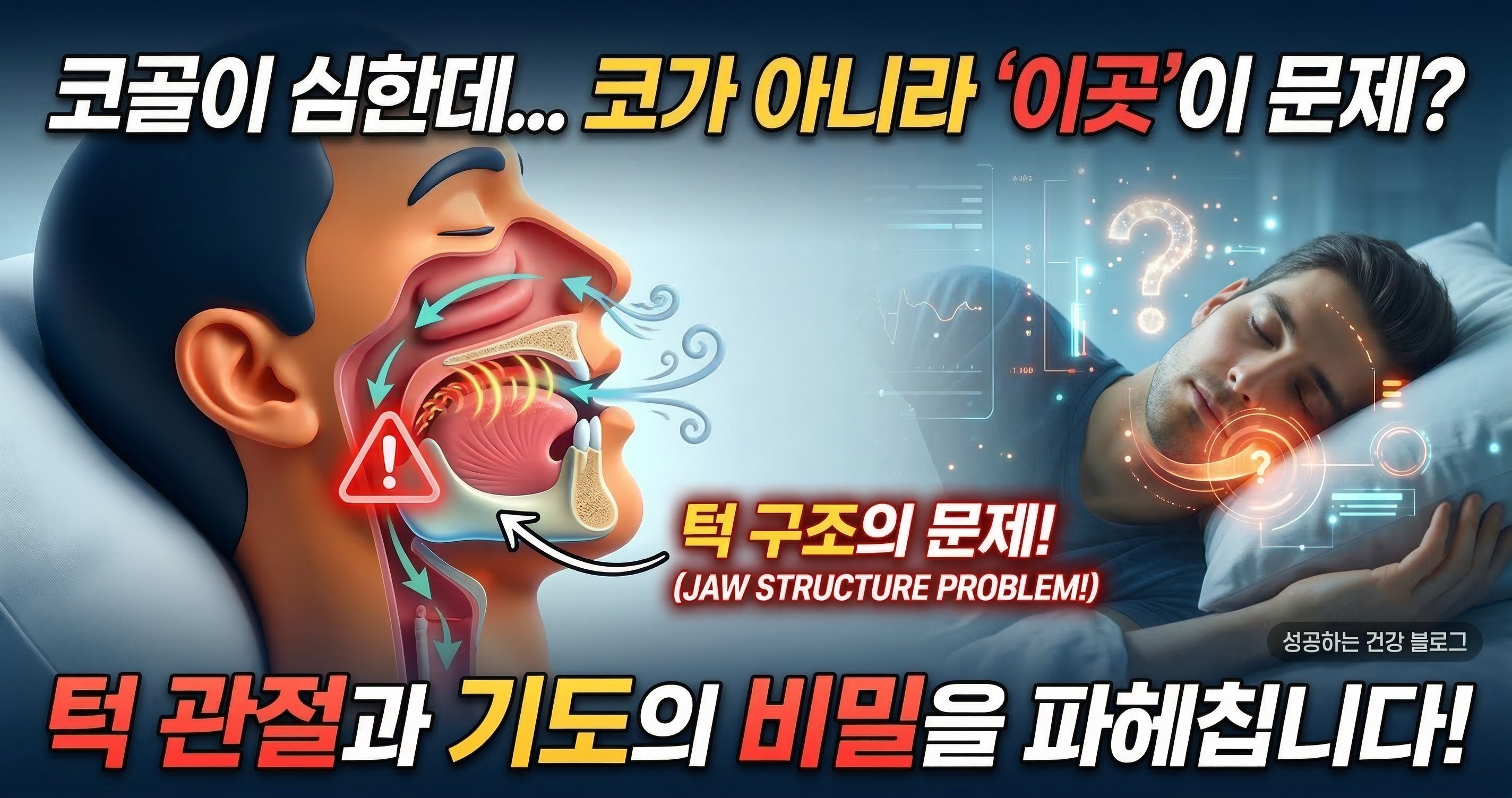 코골이가 심한데 코가 아니라 턱이 문제일 수 있어? 