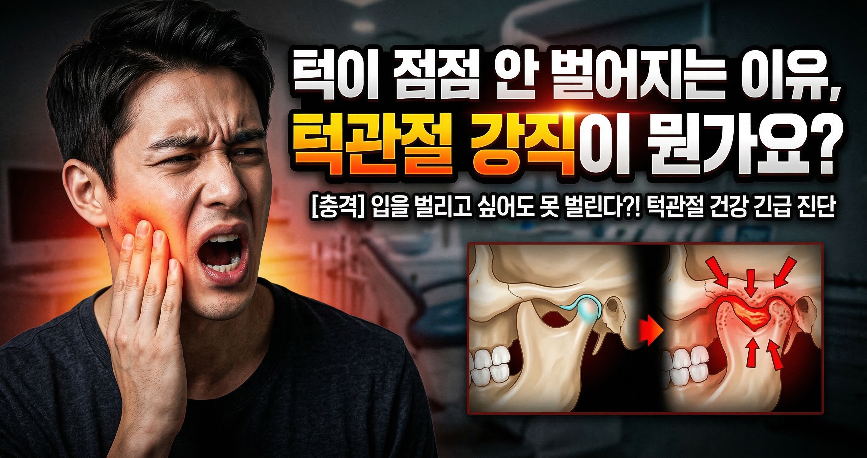 턱이 점점 안 벌어지는 이유, 턱관절 강직이 뭔가요?