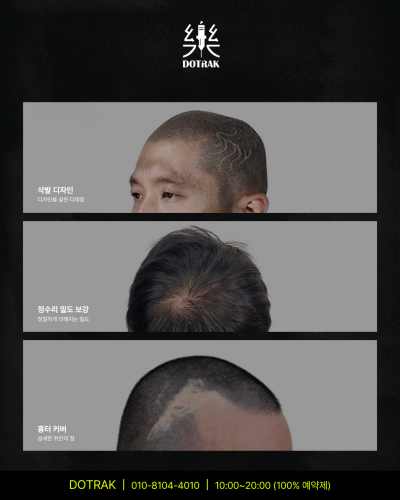 부위·상태별 SMP 밀도 표현 사례