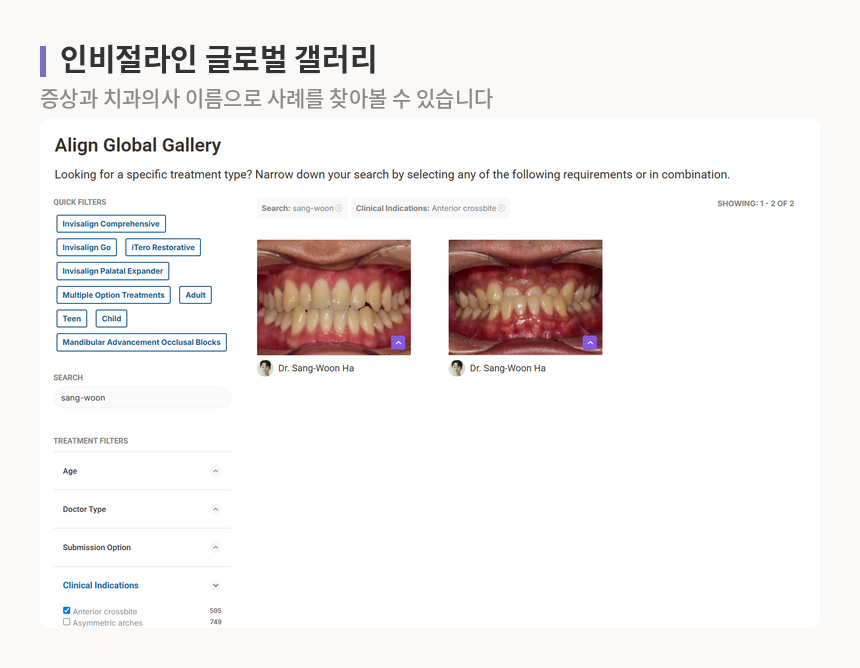 인비절라인 글로벌 갤러리에서 치과의사 이름과 앞니 반대교합 필터로 검색한 사례 목록